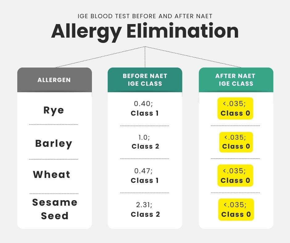 Chart titled Allergy Elimination, IgE blood test before and after NAET. Rye went from 0.40, Class 1, to under 0.035, Class 0. Barley from 1.0, Class 2, to Class 0. Wheat from 0.47, Class 1, to Class 0. Sesame seed from 2.31, Class 2, to Class 0.