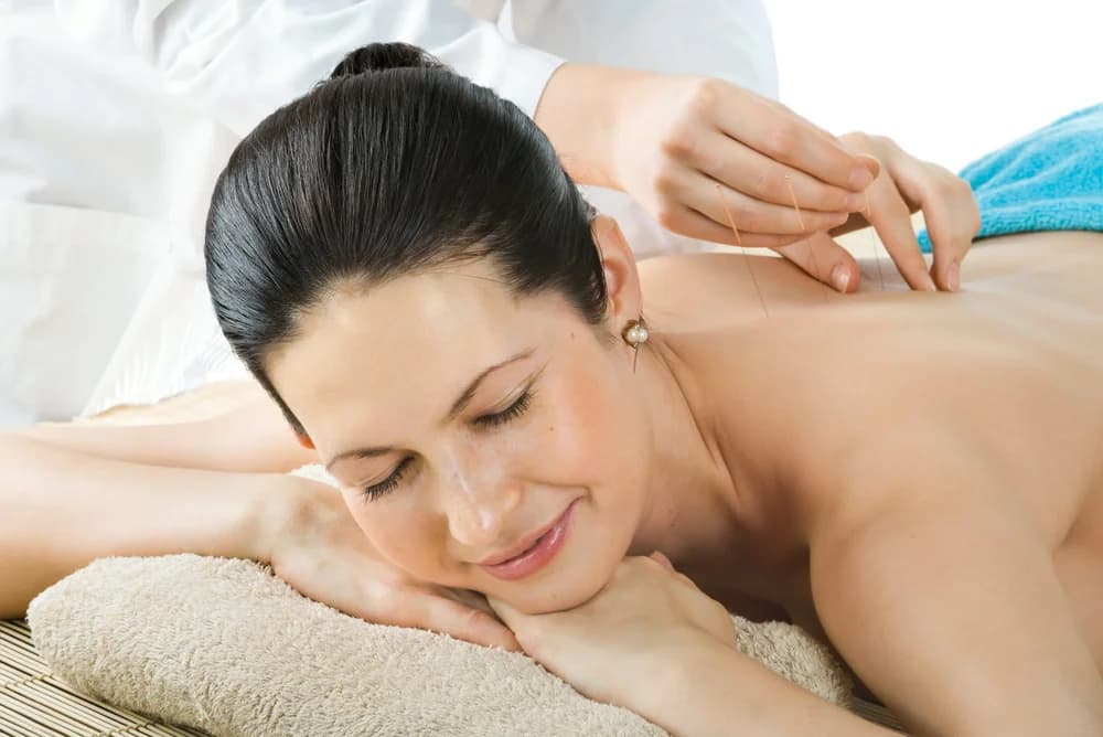 A woman lying face down and relaxed while fine acupuncture needles are placed along her upper back.